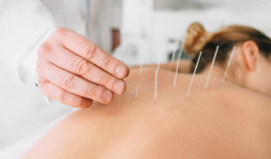 is acupuncture safe after a car accident 