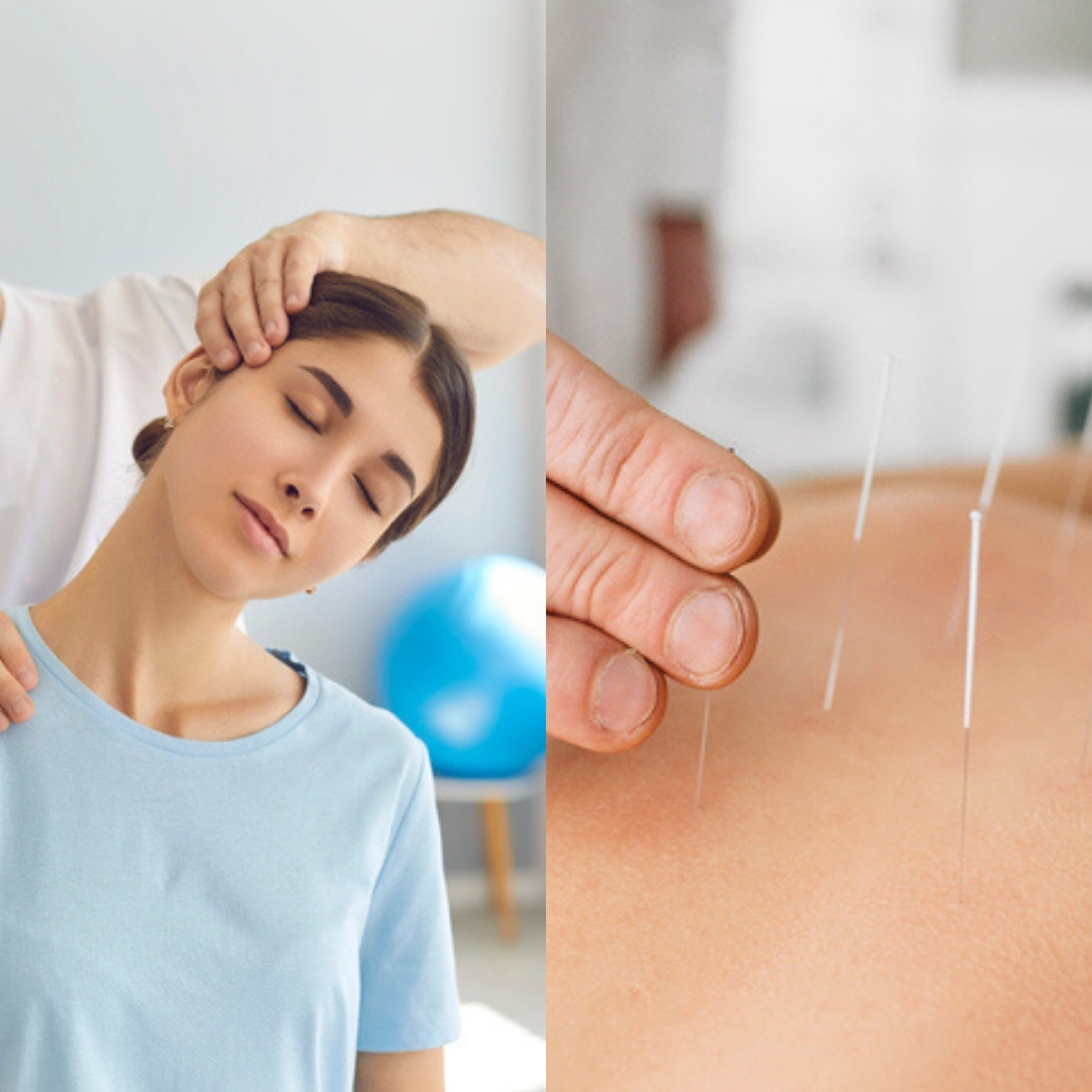 Does acupuncture work