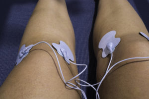 Car Accident Chiropractors - Electrical Muscle Stimulation Therapy